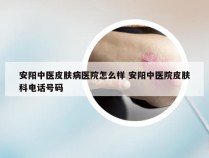 安阳中医皮肤病医院怎么样 安阳中医院皮肤科电话号码