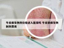 牛皮癣生物剂价格进入医保吗 牛皮肤癣生物制剂费用