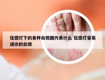 伍德灯下的各种白斑图代表什么 伍德灯容易误诊的白斑