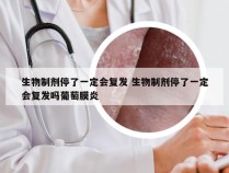 生物制剂停了一定会复发 生物制剂停了一定会复发吗葡萄膜炎