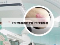 2023银屑病日主题 2021银屑病