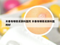 长春有哪些皮肤科医院 长春有哪些皮肤科医院好