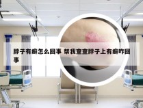 脖子有癣怎么回事 帮我查查脖子上有癣咋回事