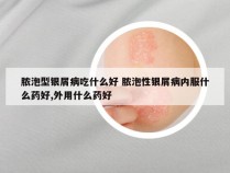 脓泡型银屑病吃什么好 脓泡性银屑病内服什么药好,外用什么药好