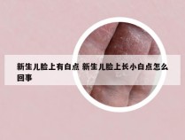 新生儿脸上有白点 新生儿脸上长小白点怎么回事