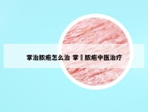 掌治脓疱怎么治 掌砳脓疱中医治疗