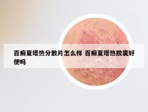 百癣夏塔热分散片怎么样 百癣夏塔热胶囊好使吗