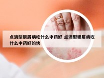 点滴型银屑病吃什么中药好 点滴型银屑病吃什么中药好的快