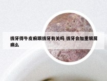 拔牙得牛皮癣跟拔牙有关吗 拔牙会加重银屑病么