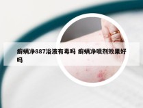 癣螨净887浴液有毒吗 癣螨净喷剂效果好吗