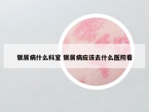 银屑病什么科室 银屑病应该去什么医院看