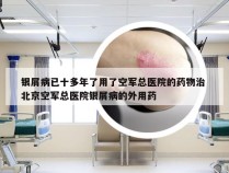 银屑病已十多年了用了空军总医院的药物治 北京空军总医院银屑病的外用药