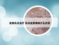 皮肤白点治疗 白点皮肤病用什么药膏