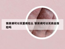 银屑病可以买重疾险么 银屑病可以买商业保险吗