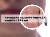 长春同春堂皮肤病医院靠谱吗 长春同春堂皮肤病医院哪个大夫看的好