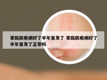 掌跖脓疱病好了半年复发了 掌跖脓疱病好了半年复发了正常吗