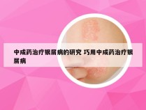 中成药治疗银屑病的研究 巧用中成药治疗银屑病