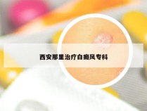 西安那里治疗白癜风专科