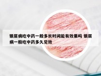 银屑病吃中药一般多长时间能有效果吗 银屑病一般吃中药多久见效