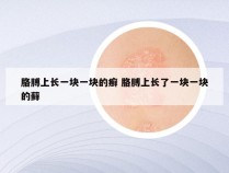 胳膊上长一块一块的癣 胳膊上长了一块一块的藓