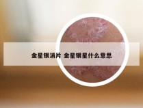 金星银消片 金星银星什么意思