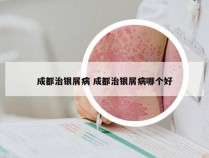 成都治银屑病 成都治银屑病哪个好