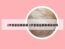 2岁感冒后银屑病 2岁感冒后银屑病会好吗