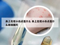 身上出现小白点是什么 身上出现小白点是什么原因图片