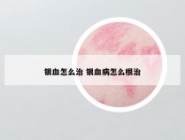 银血怎么治 银血病怎么根治