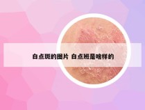 白点斑的图片 白点班是啥样的