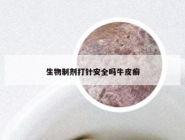 生物制剂打针安全吗牛皮癣