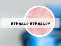 腋下长癣怎么办 腋下长癣怎么办啊