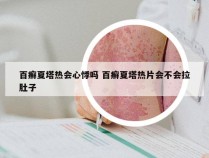 百癣夏塔热会心悸吗 百癣夏塔热片会不会拉肚子