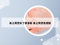 身上突然长了很多藓 身上突然出现藓