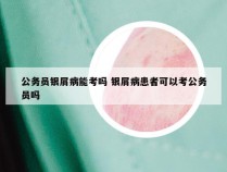 公务员银屑病能考吗 银屑病患者可以考公务员吗