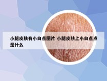 小腿皮肤有小白点图片 小腿皮肤上小白点点是什么