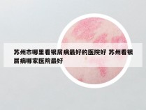 苏州市哪里看银屑病最好的医院好 苏州看银屑病哪家医院最好