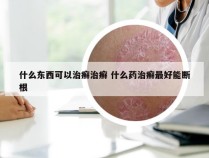 什么东西可以治癣治癣 什么药治癣最好能断根