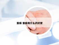 蚕癣 蚕癣用什么药好使