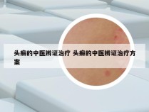 头癣的中医辨证治疗 头癣的中医辨证治疗方案