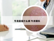 牛鼻藓是什么病 牛鼻鲼科