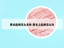 眉毛起癣怎么去除 眉毛上起癣怎么办