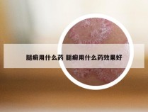 腿癣用什么药 腿癣用什么药效果好