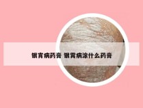 银宵病药膏 银霄病涂什么药膏