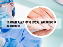 消银颗粒儿童11岁可以吃吗 消银颗粒可以长期服用吗