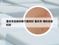 重庆市皮肤科哪个医院好 重庆市 哪的皮肤科好