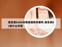 维生表b2b6对银屑病有郊果吗 维生表b2有什么作用