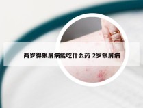 两岁得银屑病能吃什么药 2岁银屑病