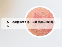 身上长癣像数字8 身上长的像癣一样的是什么