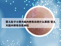 婴儿肚子小便大腿内侧有白斑什么原因 婴儿大腿内侧有白色米粒